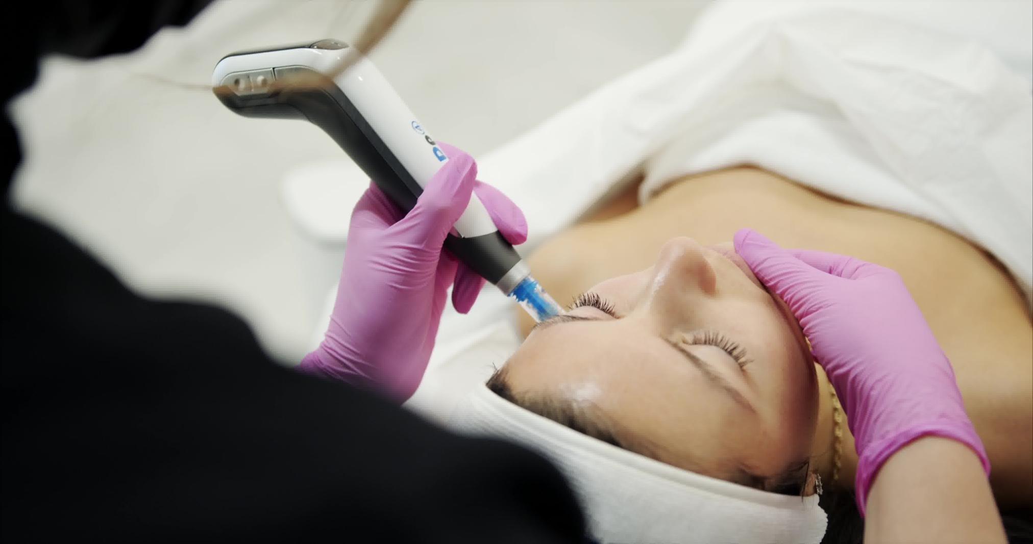 Rejuvenation du Cou par Microneedling