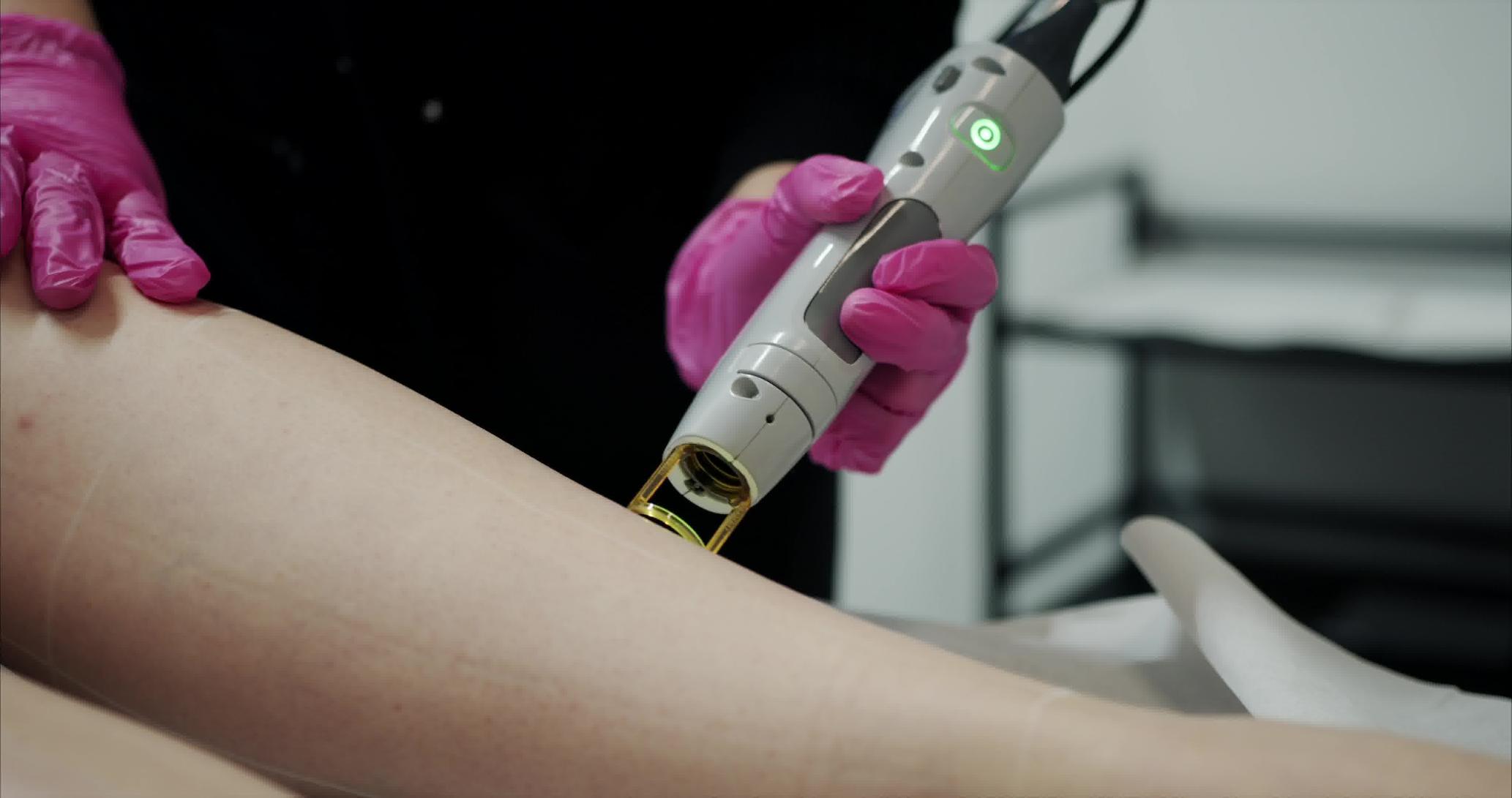 Traitement de l'acné au New Age Spa