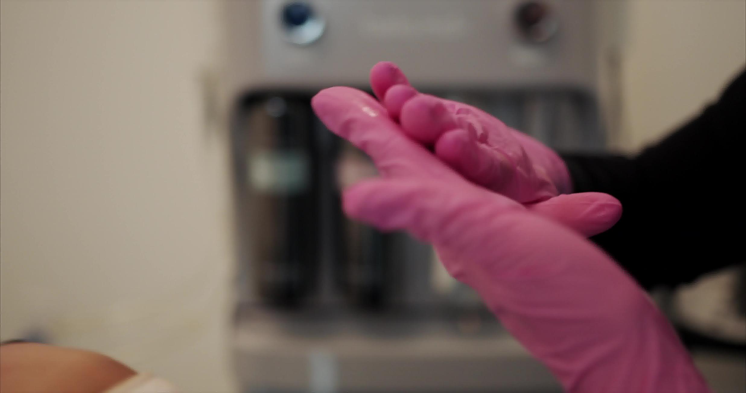 Traitement d'hyperpigmentation