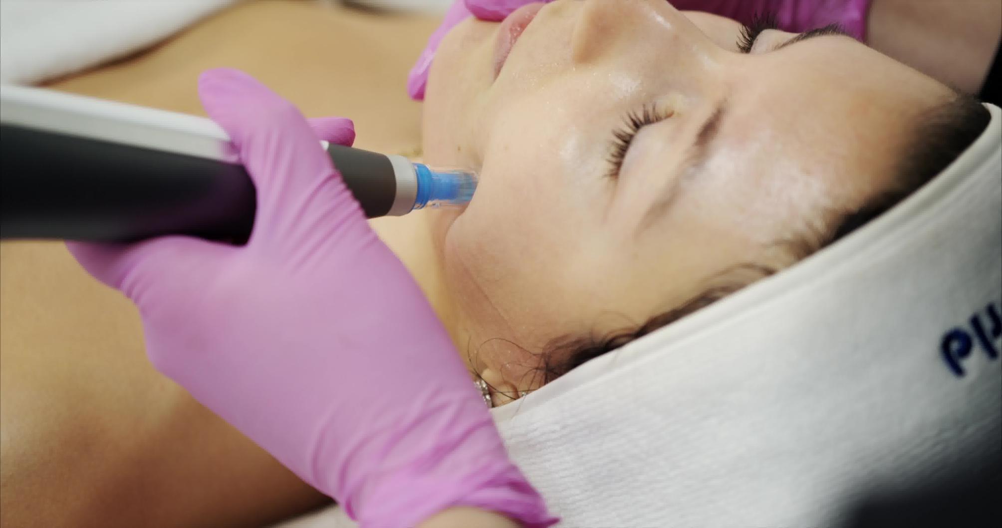 Handwriting Tattoo Removal