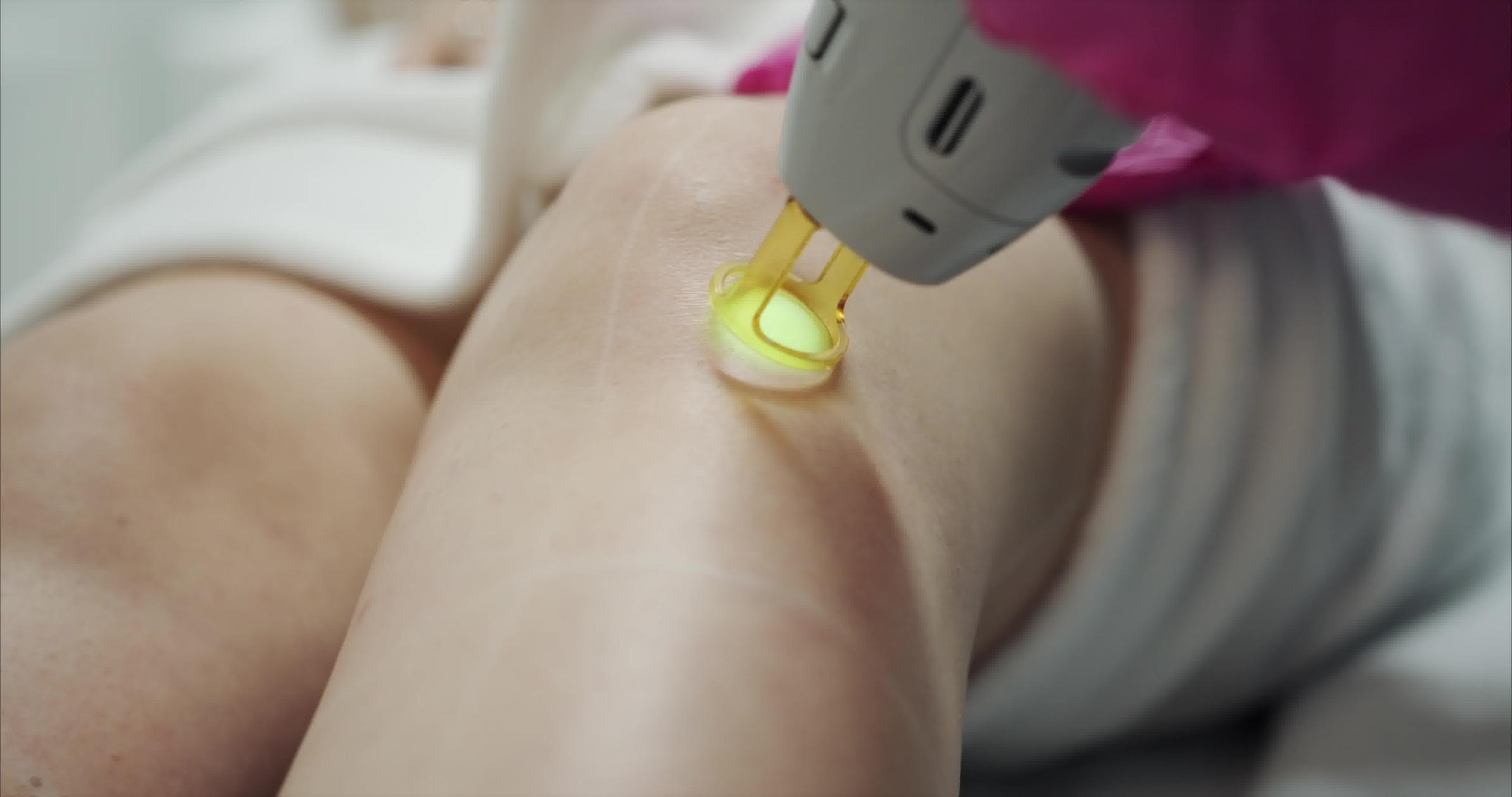 Full body laser treatment — New Age Spa
